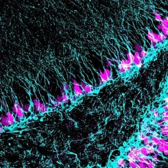 fotonoticia_20250814125809_1920