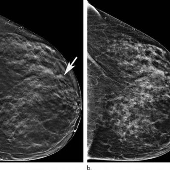 fotonoticia_20251020185320_1920