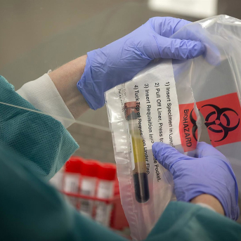 Una muestra de saliva para una prueba de sarampión en los CDC de Minnesota (EEUU) Europa Press/Contacto/Elizabeth Flores