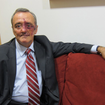 Abierta una acción para financiar el Proyecto CRIS Cáncer de Páncreas de Mariano Barbacid EUROPA PRESS