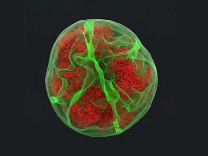 Un estudio expone que células leucémicas muestran una 'huella' tras atravesar tejidos que altera su núcleo y funciones CSIC