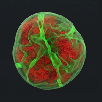 Un estudio expone que células leucémicas muestran una 'huella' tras atravesar tejidos que altera su núcleo y funciones CSIC