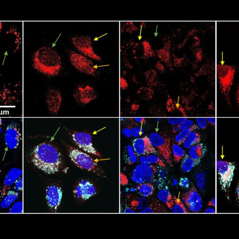 En rojo, el fármaco después del tratamiento térmico se dispersa por la célula y alcanza el núcleo (en azul). ICMM