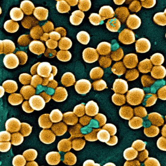 Vista de estafilococo dorado ('Staphylococcus aureus') resistente a meticilina. USCDCP