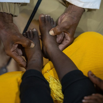 Un niño en un programa terapéutico del Fondo de Naciones Unidas para la Infancia (UNICEF) en el centro de salud Marjan al Amal en el estado de Gezira (archivo) AHMED MOHAMDEEN ELFATIH/UNICEF