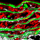 Detalle de la pared de la aorta en un modelo experimental de síndrome de Marfan. IVÁN ALARCÓN, CBM
