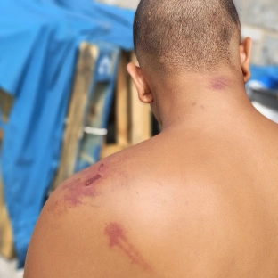 Amnistía Internacional denuncia maltrato de los militares a los migrantes en Ceuta. Amnistía Internacional. Amnistía Internacional denuncia maltrato de los militares a los migrantes en Ceuta. Amnistía Internacional.