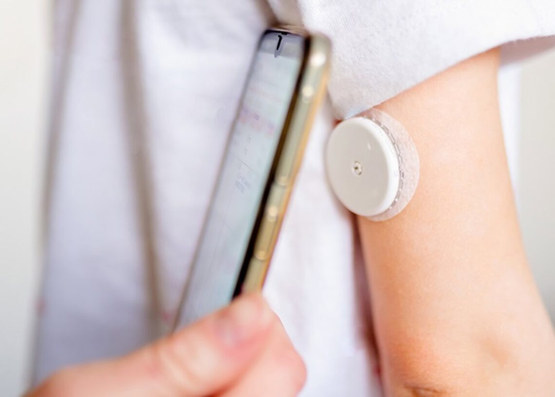 Archivo - Sistema de Monitorización Flash de Glucosa (MFG).JUNTA DE ANDALUCIA - Archivo