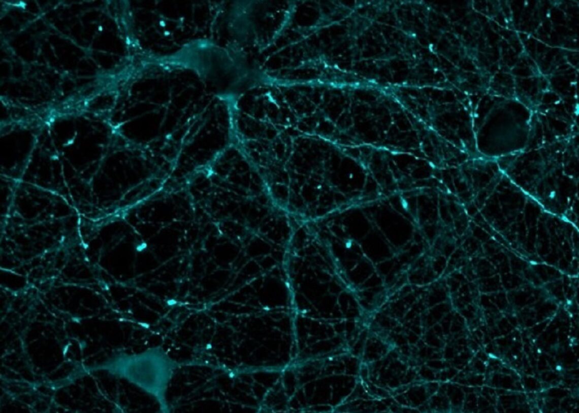 Imagen de microscopía con neuronas teñidas con marcadores estudiados en este trabajo. /F. JAVIER DÍEZ GUERRA (CBM)