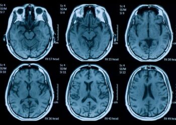 Identifican un compuesto con un efecto neuroprotector "significativo" en traumatismo craneoencefálico.CSIC