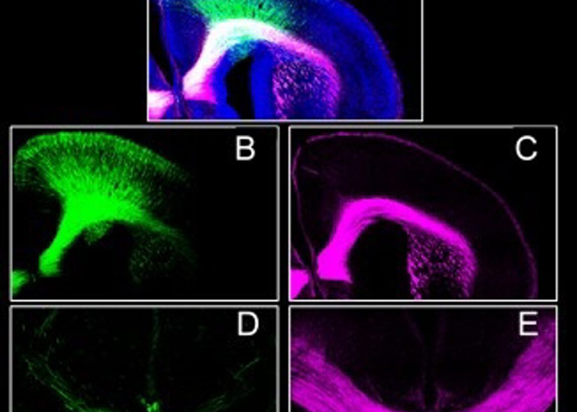 Archivo - La ausencia del receptor CB1 en el desarrollo embrionario altera la formación de la corteza prefrontalUCM - Archivo