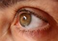 Archivo - OjoASOCIACIÓN DE GLAUCOMA PARA AFECTADOS Y FAMILIARES