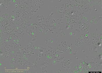 La imagen representa las células de cáncer muertas al activarse su proteína de membrana PAR-1 por la proteasa bacteriana HapA.CIC