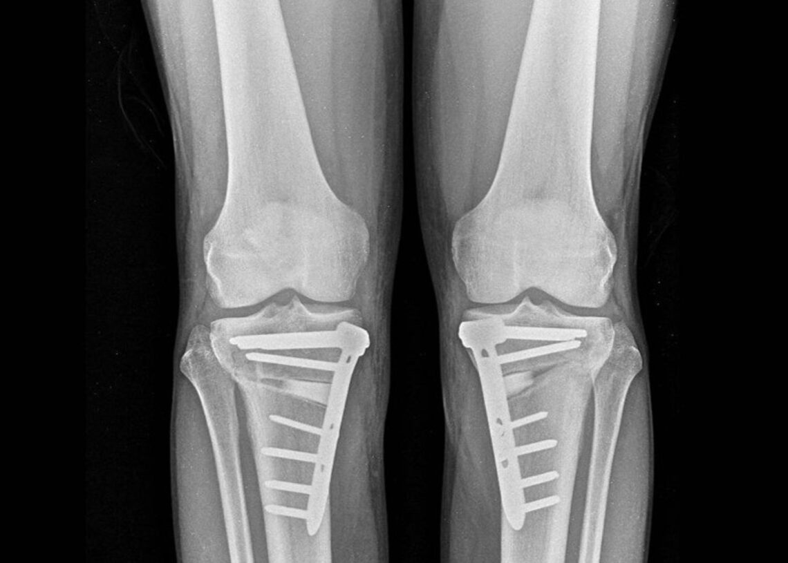 Radiografías de rodilla.SOCIALNIUS