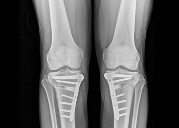 Radiografías de rodilla.SOCIALNIUS
