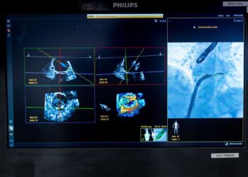 Dispositivo DeviceGuide de Philips.PHILIPS