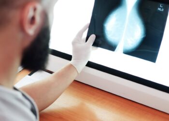 Archivo - Cáncer de mamaHOSPITAL LA LUZ - Archivo