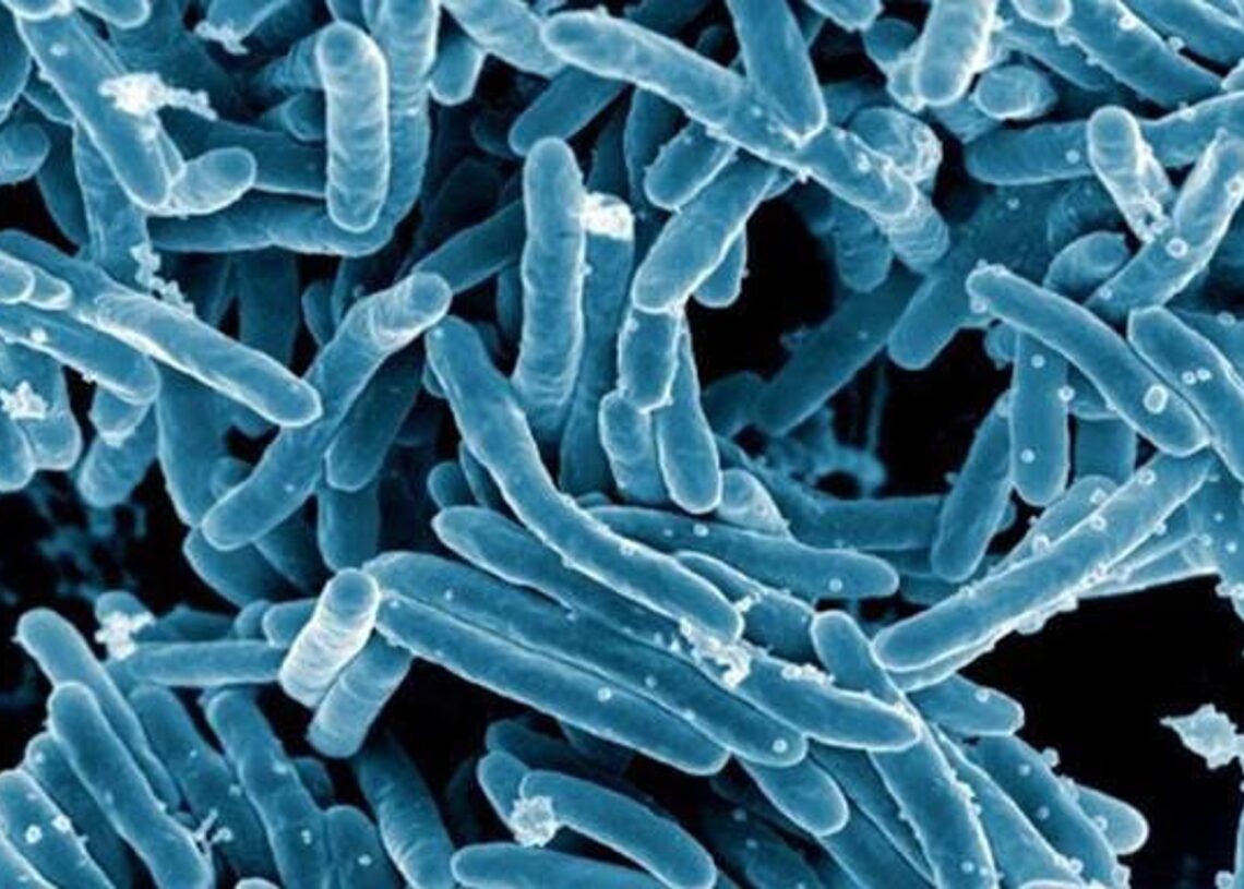 Archivo - Imagen de microscopio de la bacteria Mycobacterium tuberculosis.NIAID - Archivo