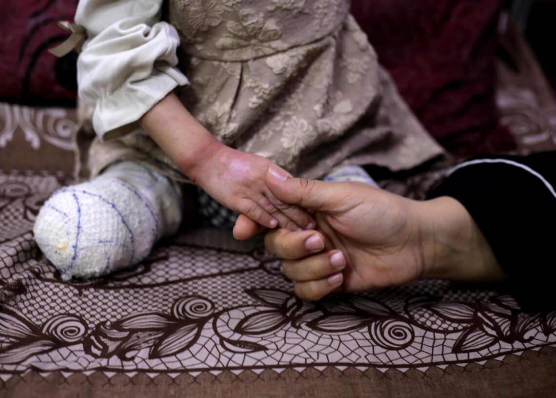 Archivo - Un niño amputado en el Hospital Mártires de Al Aqsa, en la ciudad de Deir al Balá, a causa de la ofensiva lanzada por Israel contra la Franja de Gaza tras los ataques del 7 de octubre de 2023 (archivo)Europa Press/Contacto/Rizek Abdeljawad - Archivo