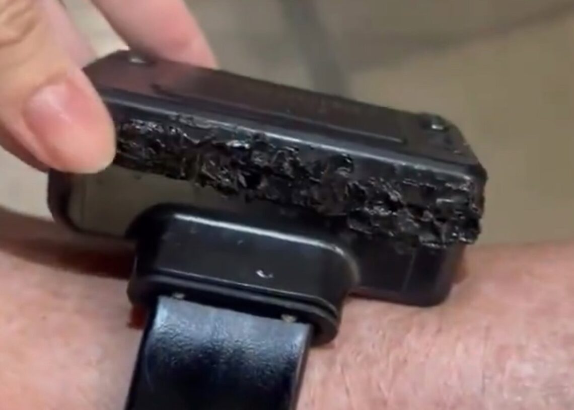 Tobillera de Jair Bolsonaro dañada por un soldadorFISCALÍA FEDERAL DE BRASIL