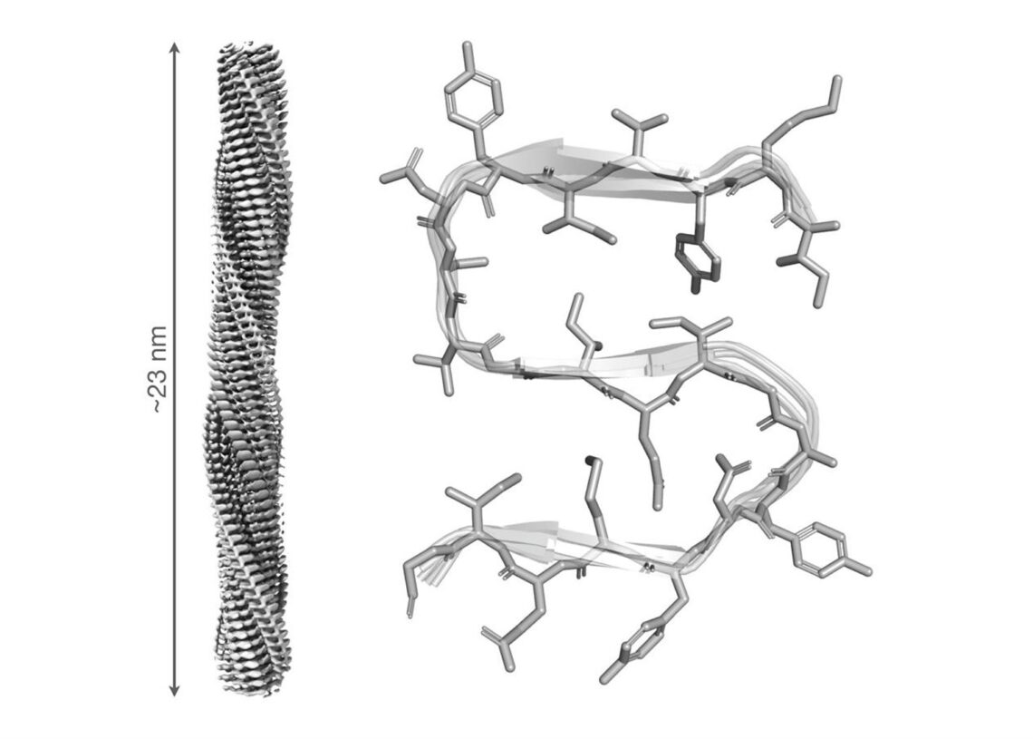 Imagen de la estructura del ensamblaje formado por la proteína RIPK1.IQF-CSIC